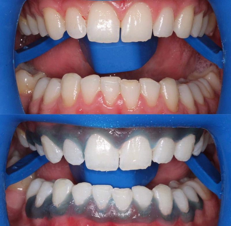 Работы Копосова (Хадырова) Айзанат Темирсултановна